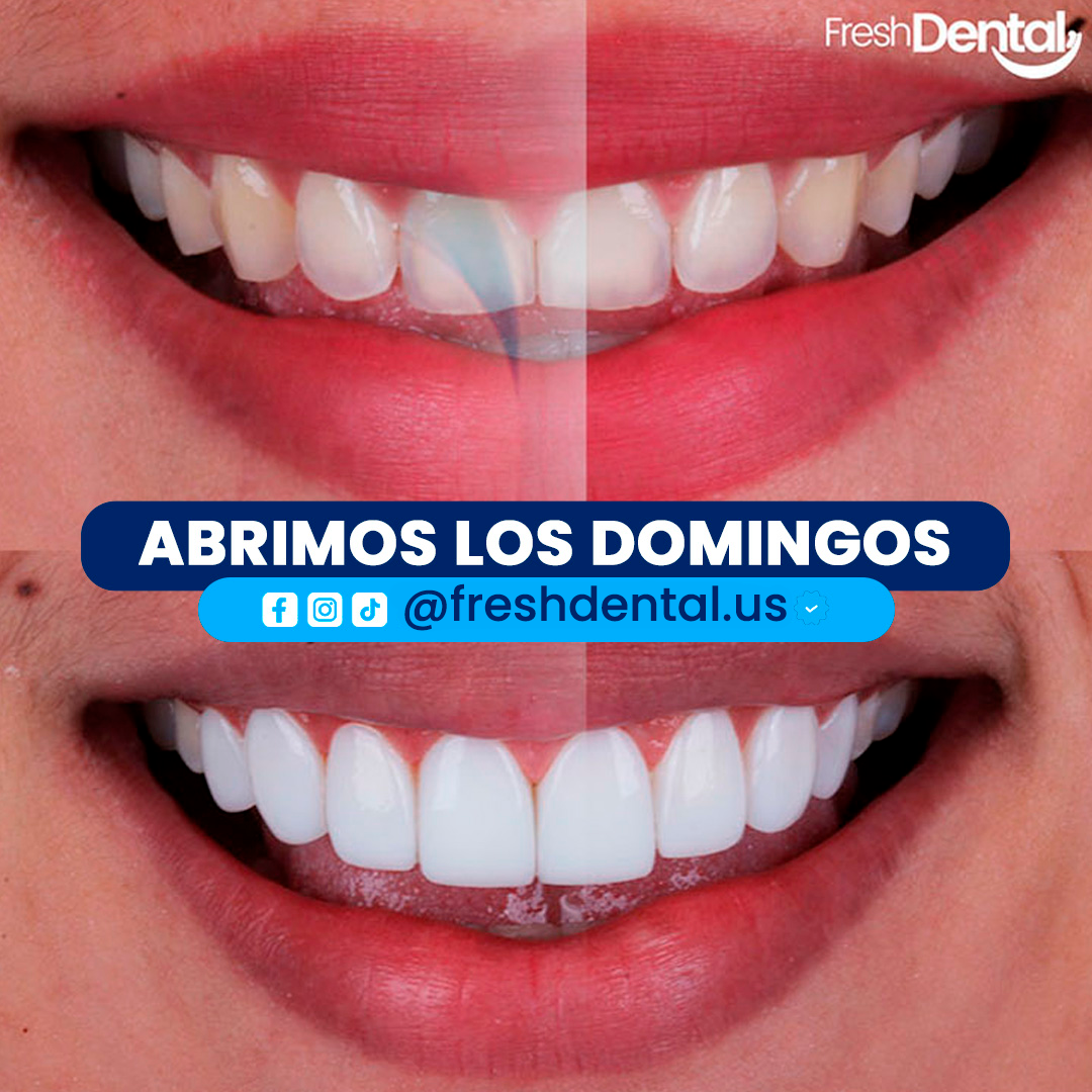 fresdental-us-2
